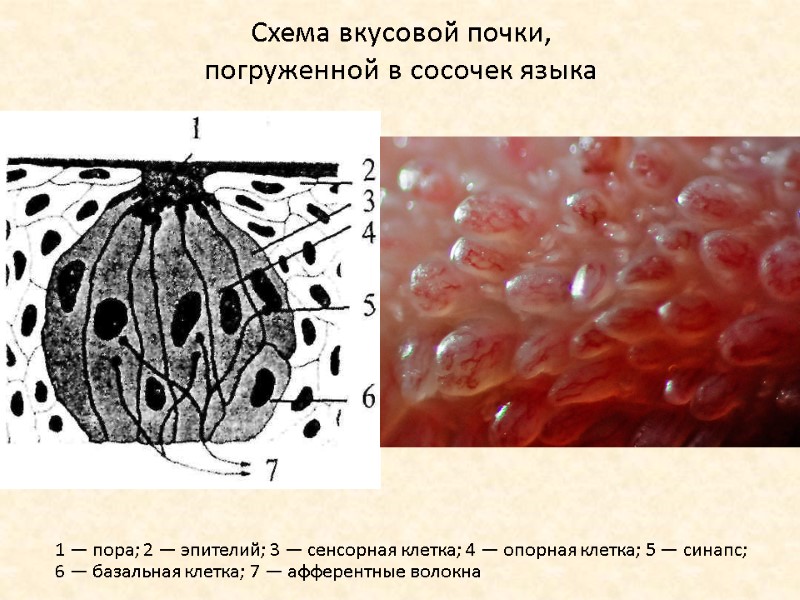 Схема вкусовой почки,  погруженной в сосочек языка 1 — пора; 2 — эпителий;